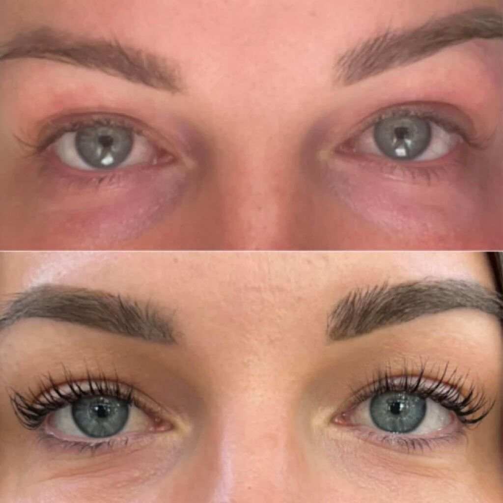 Lash Growth Serum